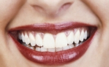 A szájban lévő baktériumok okozhatják a vastagbélrákot