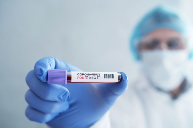 Huszonhárom személyt tesztelnek Tamásiban 