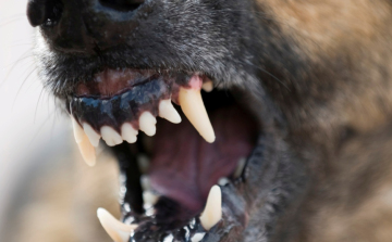 Kutyájára támadt egy másik eb - őt is megharapta